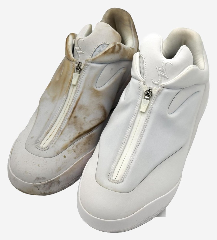 Sneakers blanches zippées : à gauche jaunie et tachée, à droite blanche
